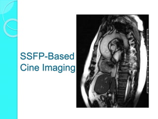 Ssfp Mri Example Steady State Free Precession MRA | PPTX