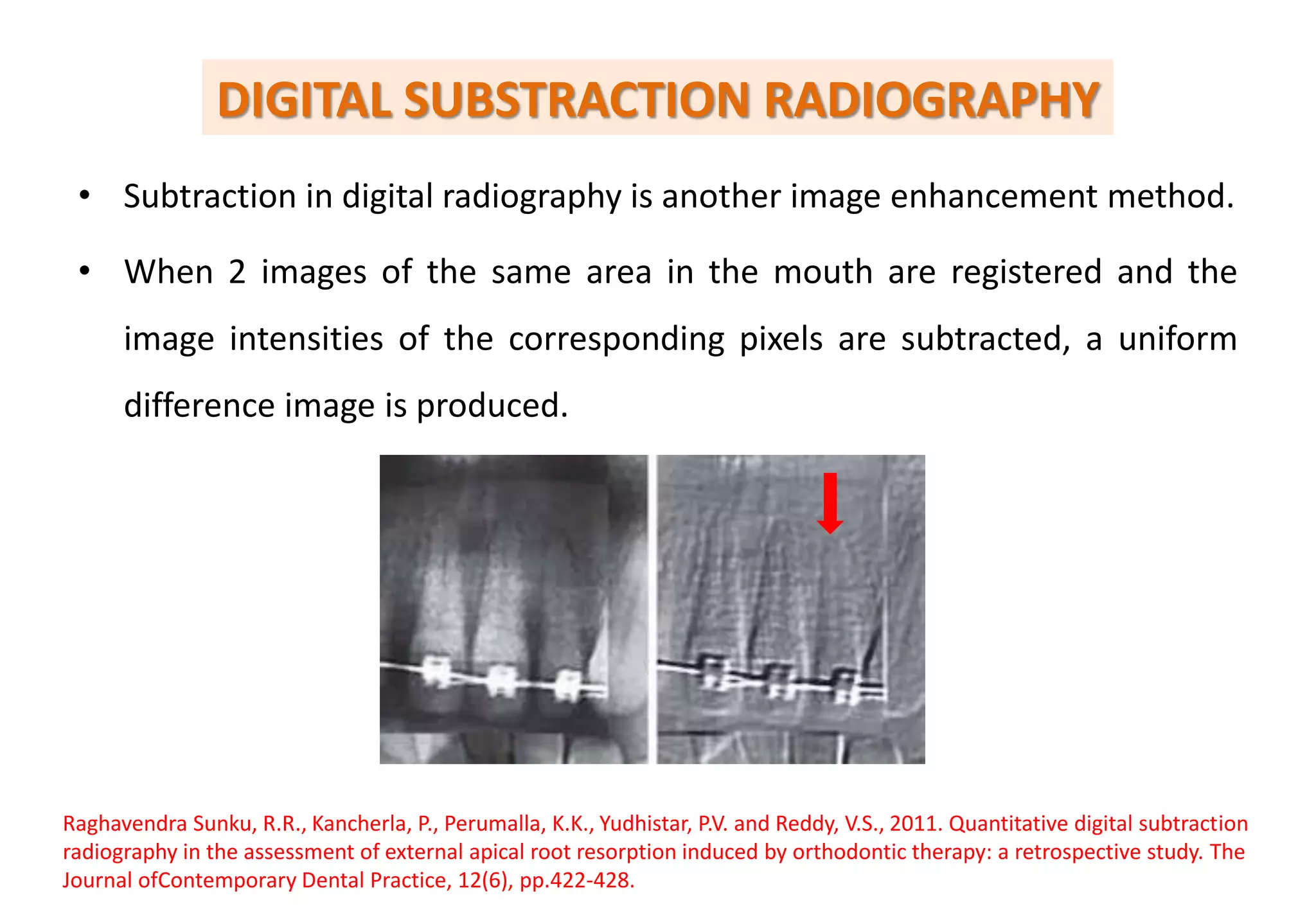 RECENT ADVANCES IN ORTHODONTIC DIAGNOSTIC AIDS | PPTX