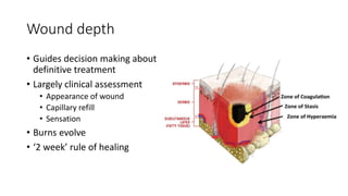 Surgical Guide.pdf Surgical management of burn injuries | PPTX