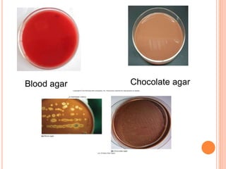 Blood agar Chocolate agar
 