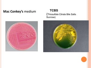 Mac Conkey’s medium TCBS
(Thiosulfate Citrate Bile Salts
Sucrose)
 