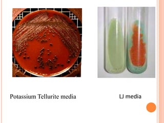 Potassium Tellurite media LJ media
 