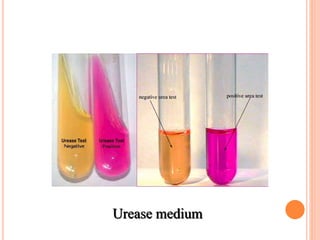 Urease medium
 