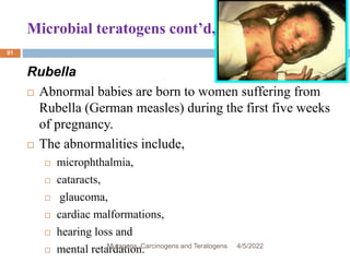 Microbial teratogens cont’d,…
91
Rubella
 Abnormal babies are born to women suffering from
Rubella (German measles) during the first five weeks
of pregnancy.
 The abnormalities include,
 microphthalmia,
 cataracts,
 glaucoma,
 cardiac malformations,
 hearing loss and
 mental retardation. 4/5/2022
Mutagens, Carcinogens and Teratogens
 