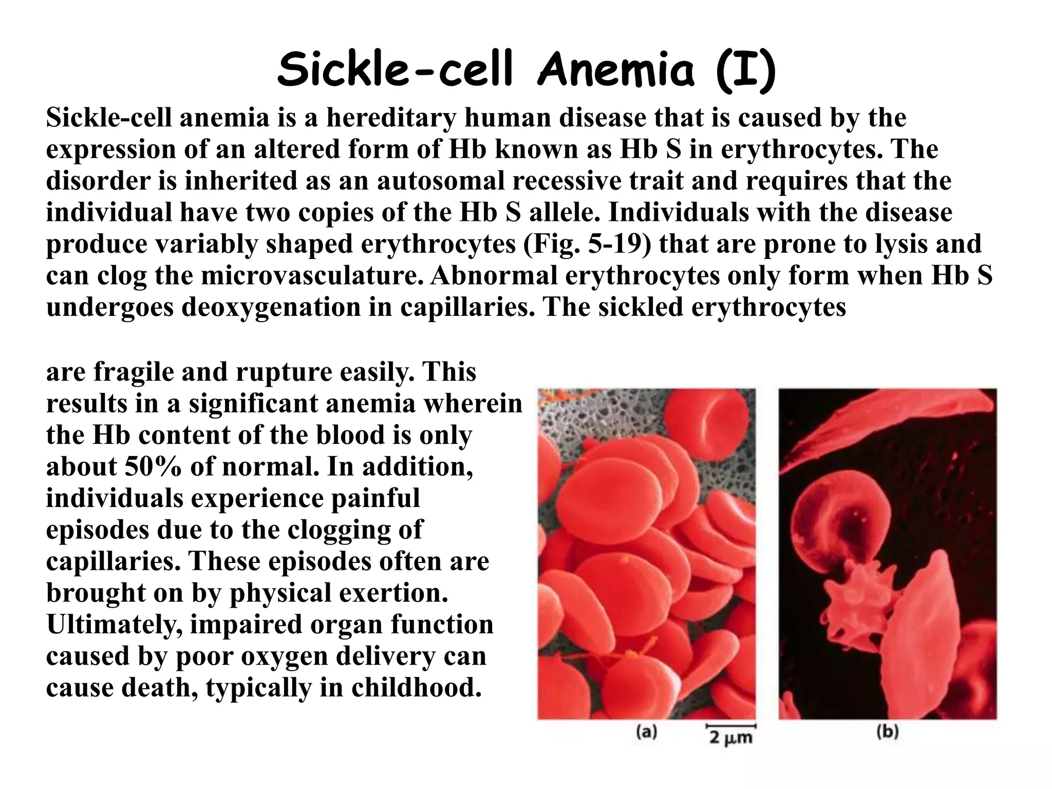3.Hemoglobin and myoglobin structure and function.ppt