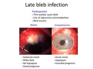 Blebitis
Predisposition
• Thin-walled, cystic bleb
• Use of adjunctive antimetabolites
• Bleb trauma
• Subacute onset
• Milky bleb
• No hypopyon
• Good prognosis
• Acute onset
• Hypopyon
• Guarded prognosis
Endophthalmitis
Late bleb infection
 