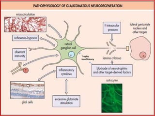 Trophic
insufficiency
 