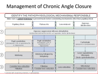 Management of Chronic Angle Closure
 
