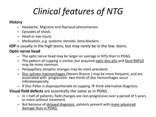 Clinical features of NTG
History
– Headache, Migraine and Raynaud phenomenon.
– Episodes of shock.
– Head or eye injury.
– Medication, e.g. systemic steroids, beta-blockers.
IOP is usually in the high teens, but may rarely be in the low teens.
Optic nerve head
– The optic nerve head may be larger on average in NTG than in POAG.
– The pattern of cupping is similar, but acquired optic disc pits and focal RNFLD
may be more common.
– Peripapillary atrophic changes may be more prevalent.
– Disc splinter haemorrhages (Steven Drance ) may be more frequent, and are
associated with progression. two-thirds of disc hemorrhages occur
inferotemporally.
– If Disc Pallor is disproportionate to cupping  think alternative diagnosis.
Visual field defects are essentially the same as in POAG .
– In > half of patients, field changes are non-progressive over a period of 5 years
or more without treatment.
– But because of delayed diagnosis, patients present with more advanced
damage than in POAG.
 