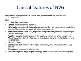 Clinical features of NVG
Symptoms - asymptomatic to severe pain, decreased vision, redness and
photophobia.
Signs-
• Conjunctival congestion
• Cornea. leads to corneal oedema.
• IOP may be normal early in the disease process, but is frequently extremely high
later on. The anterior segment will often be congested .
• Anterior chamber. Flare, cells, hyphema and posterior synechiae , depending on
severity and stage.
• Pupillary margin. Subtle vessels at the pupillary margin are often an early sign.
Afferent pupillary defect - Diagnosis at this stage is likely to substantially improve
the prognosis.
• Iris - NVI / NVA
• Gonioscopy. NVA without other signs, particularly after CRVO. Synechial angle
closure
• Cataract due to underlying Ischaemia.
• Posterior segment. Signs as per aetiology and Glaucomatous optic neuropathy .
 