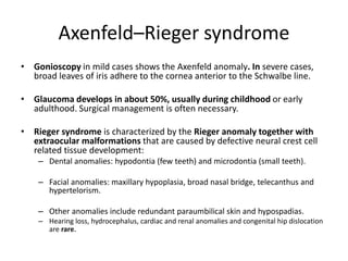Axenfeld–Rieger syndrome
• Gonioscopy in mild cases shows the Axenfeld anomaly. In severe cases,
broad leaves of iris adhere to the cornea anterior to the Schwalbe line.
• Glaucoma develops in about 50%, usually during childhood or early
adulthood. Surgical management is often necessary.
• Rieger syndrome is characterized by the Rieger anomaly together with
extraocular malformations that are caused by defective neural crest cell
related tissue development:
– Dental anomalies: hypodontia (few teeth) and microdontia (small teeth).
– Facial anomalies: maxillary hypoplasia, broad nasal bridge, telecanthus and
hypertelorism.
– Other anomalies include redundant paraumbilical skin and hypospadias.
– Hearing loss, hydrocephalus, cardiac and renal anomalies and congenital hip dislocation
are rare.
 