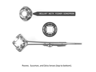 Posner, Sussman, and Zeiss lenses (top to bottom).
 