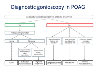 Diagnostic gonioscopy in POAG
 