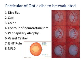 Particular of Optic disc to be evaluated
1.Disc Size
2.Cup
3.Color
4.Contour of neuroretinal rim
5.Peripapillary Atrophy
6.Vessel Caliber
7.ISNT Rule
8.NFLD
 