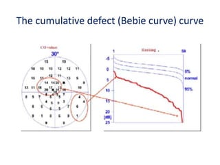 The cumulative defect (Bebie curve) curve
 