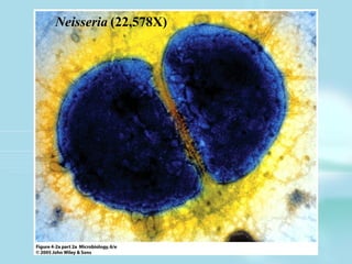 Neisseria (22,578X)
 