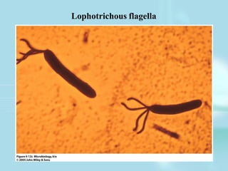 Lophotrichous flagella
 