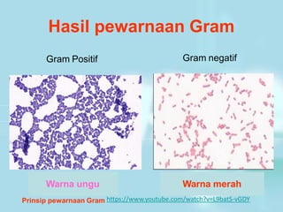 Hasil pewarnaan Gram
Gram Positif Gram negatif
Warna ungu Warna merah
https://www.youtube.com/watch?v=L9batS-vGDY
Prinsip pewarnaan Gram
 