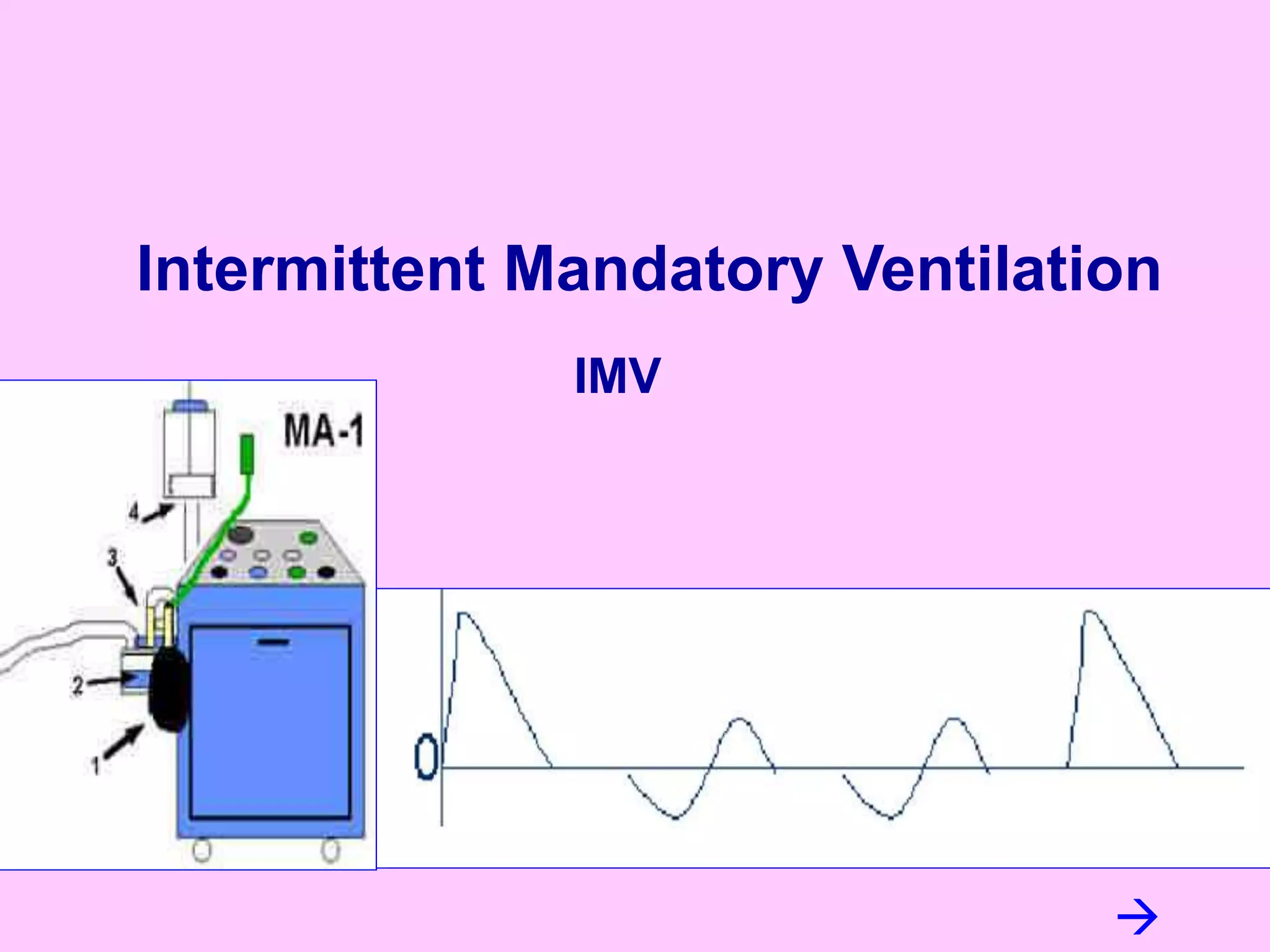 IMV
Intermittent Mandatory Ventilation

 