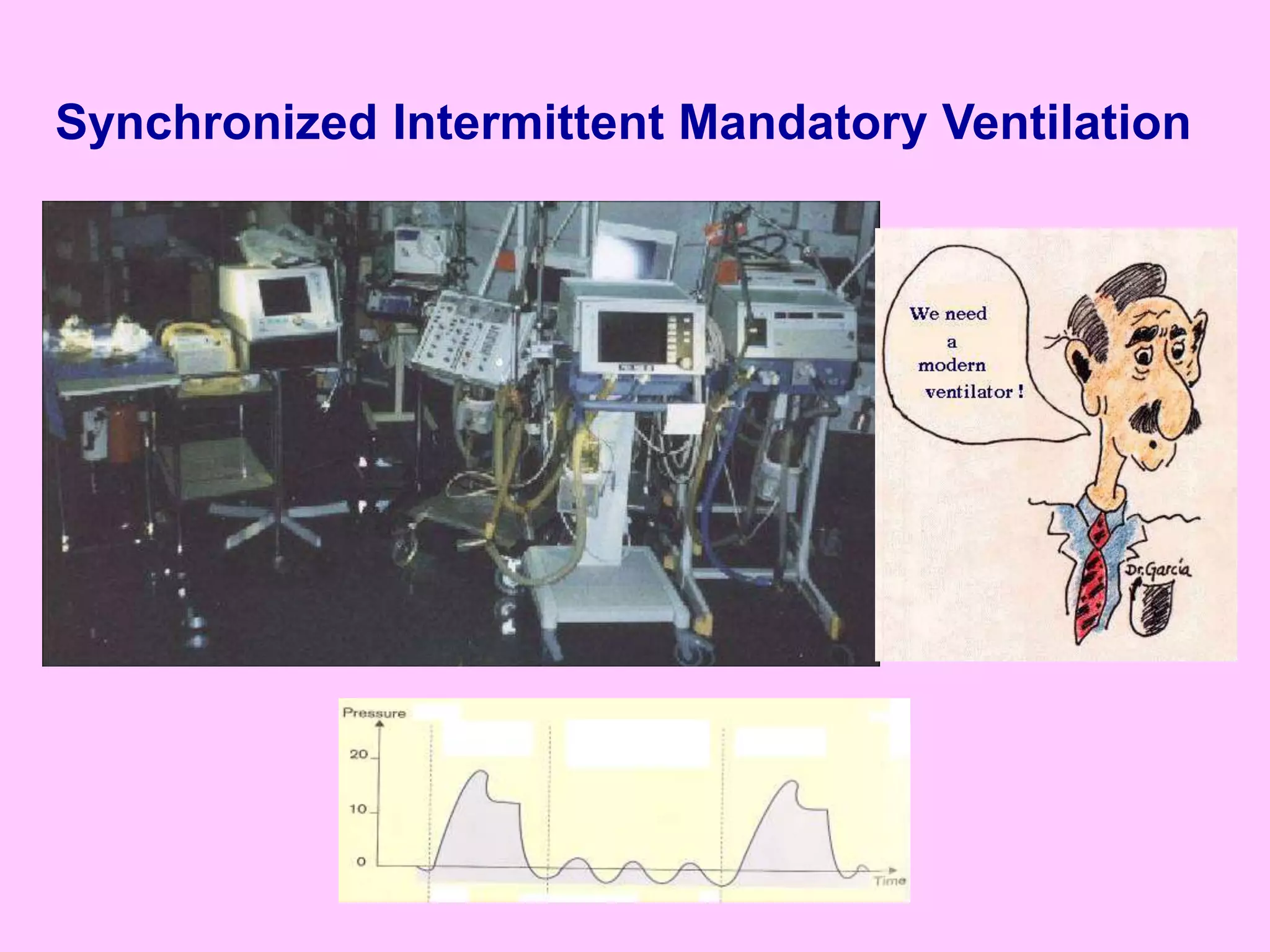 Synchronized Intermittent Mandatory Ventilation
SIMV
 