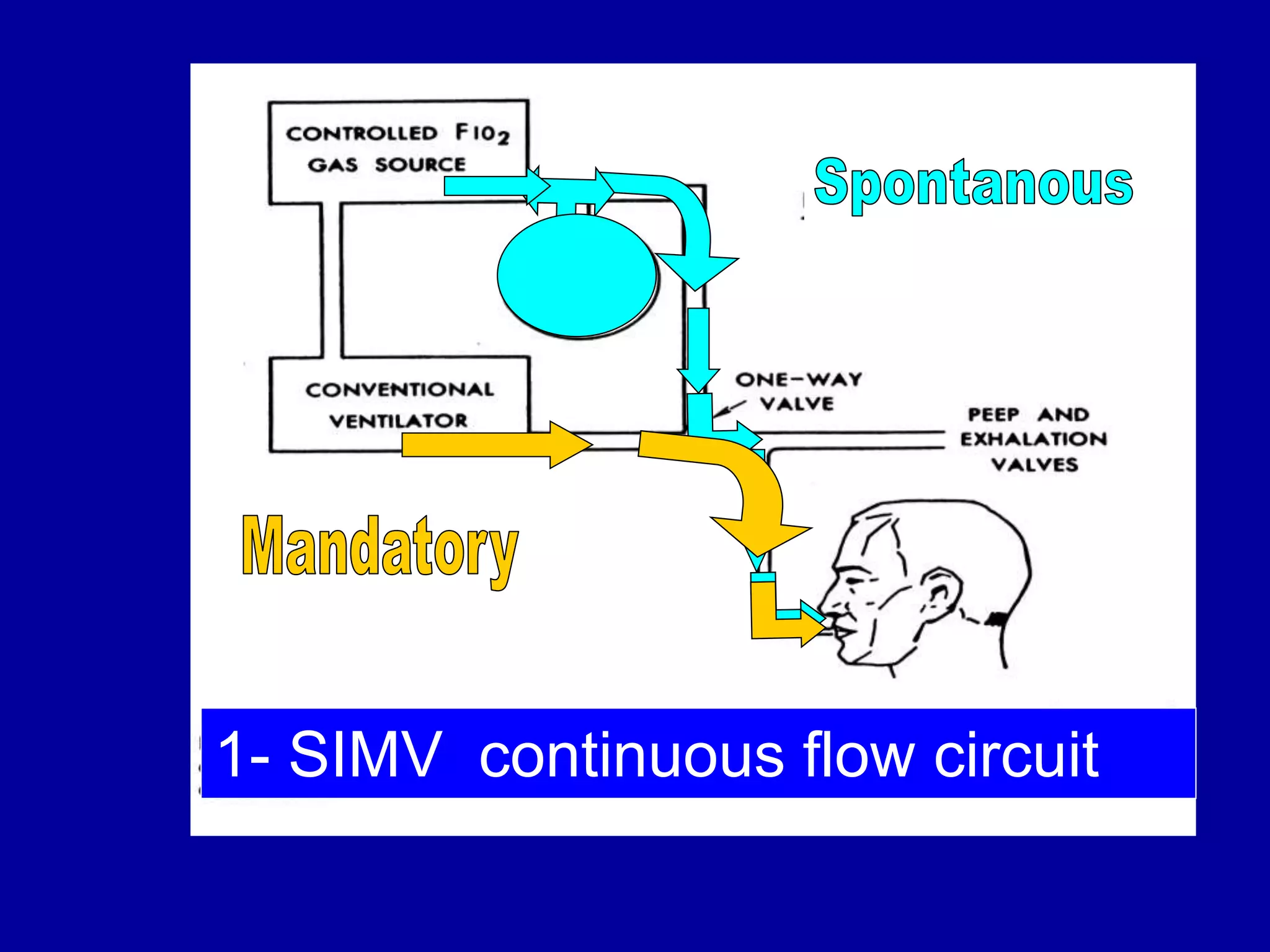 1- SIMV continuous flow circuit
 