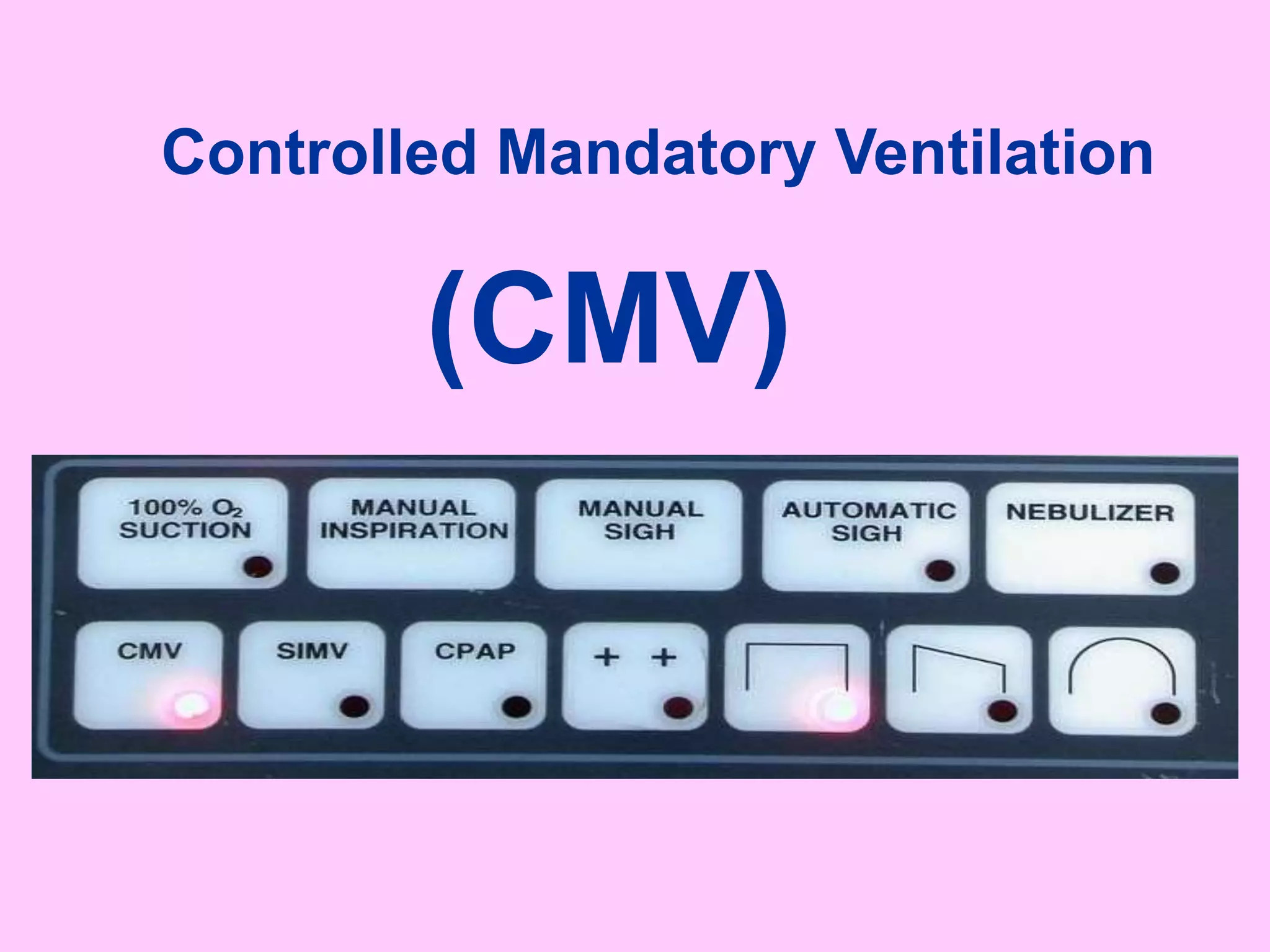 Controlled Mandatory Ventilation
(CMV)
 