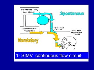 3.4.Conventional modes SIMV PSV PEEP, CPAP, IRV.ppt