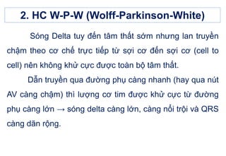 Sóng Delta tuy đến tâm thất sớm nhưng lan truyền
chậm theo cơ chế trực tiếp từ sợi cơ đến sợi cơ (cell to
cell) nên không khử cực được toàn bộ tâm thất.
Dẫn truyền qua đường phụ càng nhanh (hay qua nút
AV càng chậm) thì lượng cơ tim được khử cực từ đường
phụ càng lớn → sóng delta càng lớn, càng nổi trội và QRS
càng dãn rộng.
2. HC W-P-W (Wolff-Parkinson-White)
 
