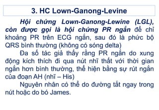 3. HC Lown-Ganong-Levine
Hội chứng Lown-Ganong-Lewine (LGL),
còn được gọi là hội chứng PR ngắn để chỉ
khoảng PR trên ECG ngắn, sau đó là phức bộ
QRS bình thường (không có sóng delta)
Đa số tác giả thấy rằng PR ngắn do xung
động kích thích đi qua nút nhĩ thất với thời gian
ngắn hơn bình thường, thể hiện bằng sự rút ngắn
của đoạn AH (nhĩ – His)
Nguyên nhân có thể do đường tắt ngay trong
nút hoặc do bó James.
 