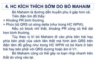 4. HC KÍCH THÍCH SỚM DO BÓ MAHAIM
Bó Mahaim là đường dẫn truyền phụ ít gặp hơn cả.
Trên điện tim đồ thấy:
+ Khoảng PR bình thường.
+ Phức bộ QRS có sóng delta (như trong HC WPW).
Nếu có block nhĩ thất, khoảng PR cũng có thể dài
hơn bình thường.
Tùy theo vị trí bó Mahaim đi vào phía bên trái hay
phía bên phải của vách liên thất mà hình ảnh QRS trên
điện tâm đồ giống như trong HC WPW có bó Kent ở bên
trái hay bên phải với QRS dương hoặc âm ở V1.
Bó Mahaim cũng có thể gây ra loạn nhịp nhanh trên
thất do vòng vào lại.
 