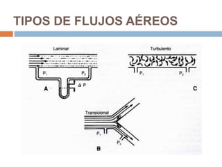 TIPOS DE FLUJOS AÉREOS
 