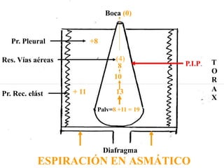 Boca (0)
Palv=8 +11 = 19
Pr. Pleural
Pr. Rec. elást
T
O
R
A
X
Res. Vías aéreas
+8
+ 11 13
P.I.P.
Diafragma
ESPIRACIÓN EN ASMÁTICO
(4)
8
10
 