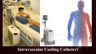 Intravascular Cooling Catheters
9/14/2022 25
 