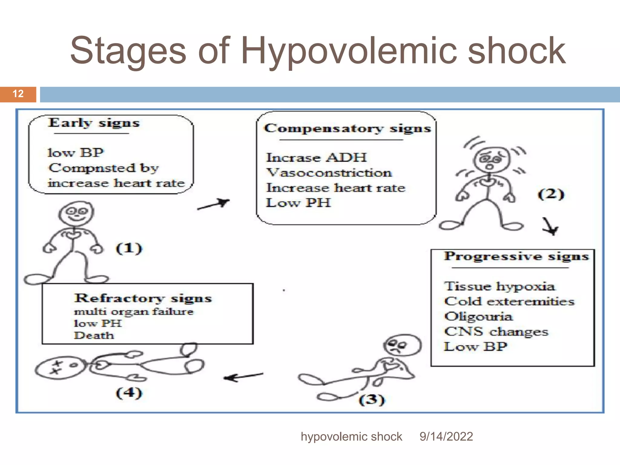 Hyovolemic shock | PPTX