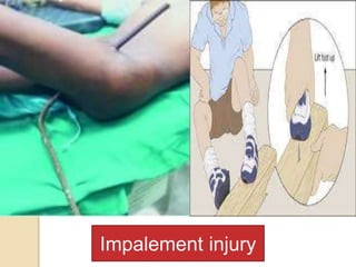 Trauma | PPTX