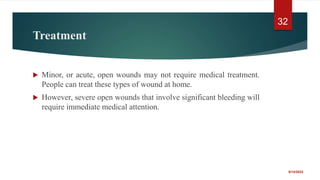 Treatment
 Minor, or acute, open wounds may not require medical treatment.
People can treat these types of wound at home.
 However, severe open wounds that involve significant bleeding will
require immediate medical attention.
9/14/2022
32
 