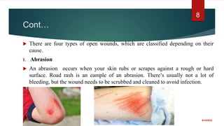 Cont…
 There are four types of open wounds, which are classified depending on their
cause.
I. Abrasion
 An abrasion occurs when your skin rubs or scrapes against a rough or hard
surface. Road rash is an eample of an abrasion. There’s usually not a lot of
bleeding, but the wound needs to be scrubbed and cleaned to avoid infection.
9/14/2022
8
 