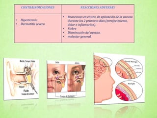 CONTRAINDICACIONES REACCIONES ADVERSAS
• Hipertermia
• Dermatitis severa
• Reacciones en el sitio de aplicación de la vacuna
durante los 2 primeros días (enrojecimiento,
dolor e inflamación).
• Fiebre
• Disminución del apetito.
• malestar general.
 