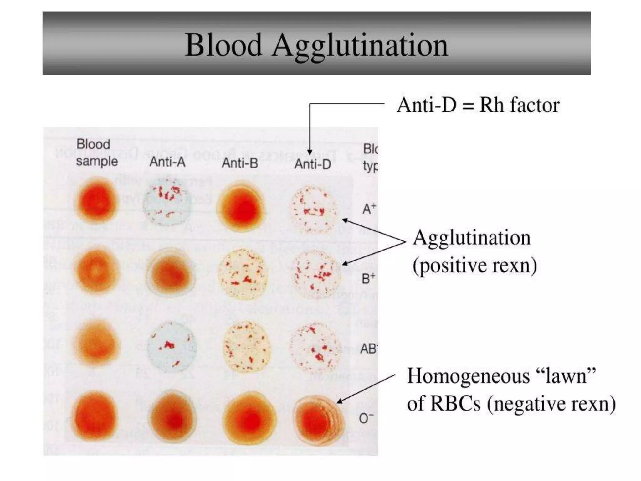 Hematopoietic systemHuman Blood,blood grouping,blood clotting PPT