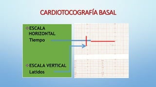 3. CLASIFICACIÓN DEL MONITOREO FETAL.pdf