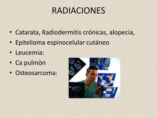 RADIACIONES
• Catarata, Radiodermitis crónicas, alopecia,
• Epitelioma espinocelular cutáneo
• Leucemia:
• Ca pulmòn
• Osteosarcoma:
 