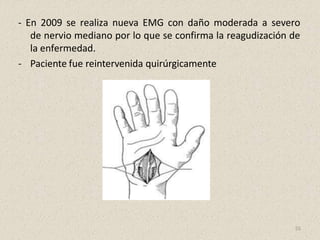 - En 2009 se realiza nueva EMG con daño moderada a severo
de nervio mediano por lo que se confirma la reagudización de
la enfermedad.
- Paciente fue reintervenida quirúrgicamente
55
 
