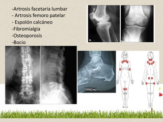 -Artrosis facetaria lumbar
- Artrosis femoro patelar
- Espolón calcáneo
-Fibromialgia
-Osteoporosis
-Bocio
67
 