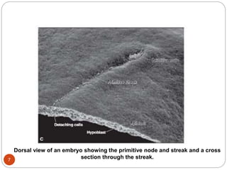 Dorsal view of an embryo showing the primitive node and streak and a cross
section through the streak.
7
 