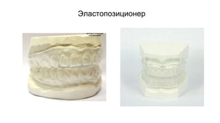 Аппараты 3.pptx