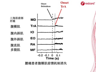 Onset
Deltoideus
Onset
TrA
腰痛患者腹横肌前馈机制消失
三角肌前部
纤维
腹横肌
腹内斜肌
腹外斜肌
腹直肌
多裂肌
 