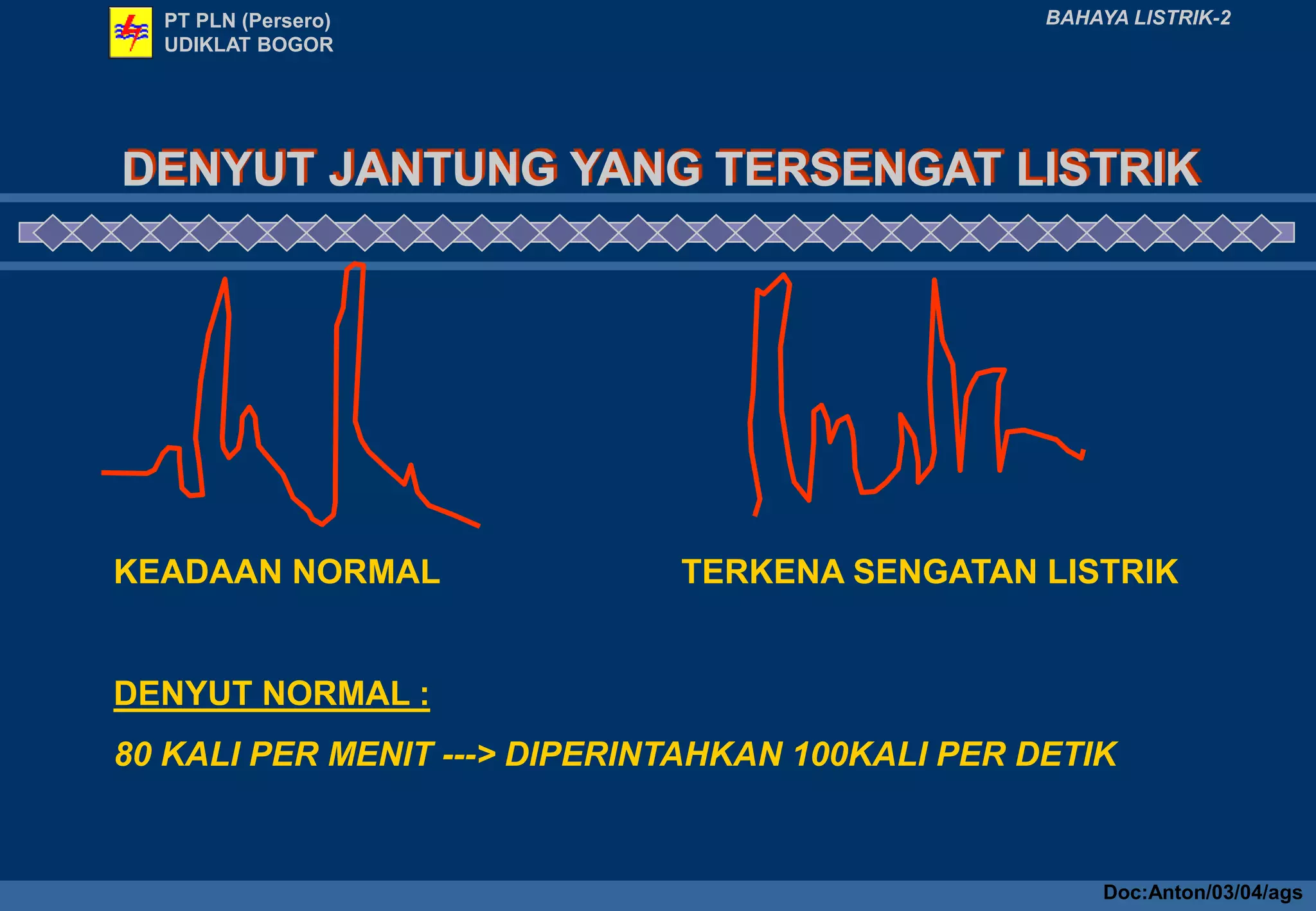 DENYUT JANTUNG YANG TERSENGAT LISTRIK
BAHAYA LISTRIK-2
KEADAAN NORMAL TERKENA SENGATAN LISTRIK
DENYUT NORMAL :
80 KALI PER MENIT ---> DIPERINTAHKAN 100KALI PER DETIK
PT PLN (Persero)
UDIKLAT BOGOR
Doc:Anton/03/04/ags
 