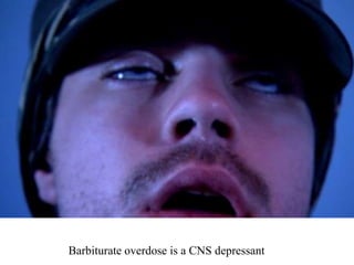 Barbiturate overdose is a CNS depressant
 