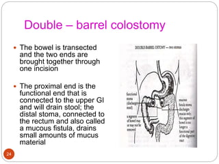 Double – barrel colostomy
 The bowel is transected
and the two ends are
brought together through
one incision
 The proximal end is the
functional end that is
connected to the upper GI
and will drain stool; the
distal stoma, connected to
the rectum and also called
a mucous fistula, drains
small amounts of mucus
material
24
 