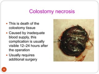 Colostomy necrosis
 This is death of the
colostomy tissue
 Caused by inadequate
blood supply, this
complication is usually
visible 12–24 hours after
the operation
 Usually requires
additional surgery
56
 